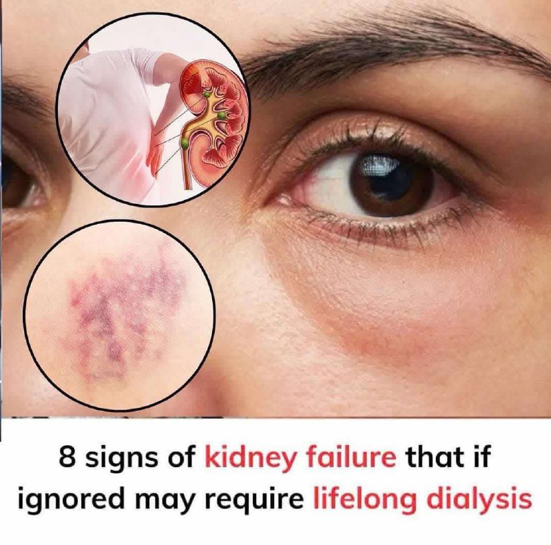 10 Signs Your Kidneys May Be in…