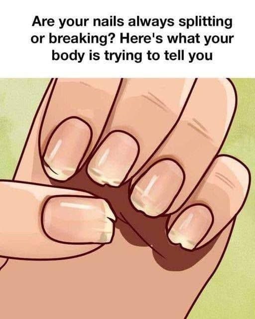 Are your nails always splitting or breaking?
