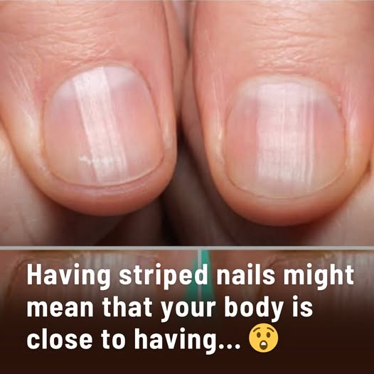 Rippled Fingernails: A Window to Your Health – What Your Nails Might Be Trying to Tell You