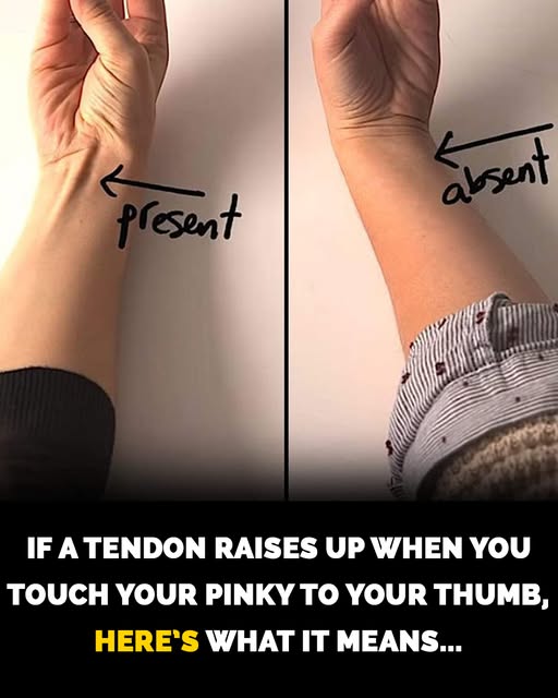 How to check if you’ve lost this tendon on your arm to evolution How to check if you’ve lost this tendon on your arm to evolution