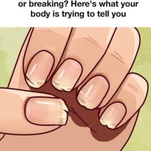 Are your nails always splitting or breaking and…
