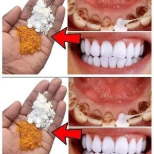 Natural Remedies with Cloves and Bay Leaves for a Brighter Smile Natural Remedies with Cloves and Bay Leaves for a Brighter Smile