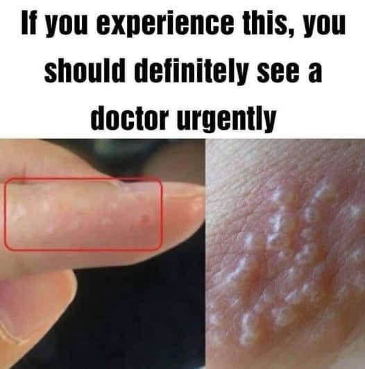 Ií you experience this, you should definitely see a doctor urgently Ií you experience this, you should definitely see a doctor urgently