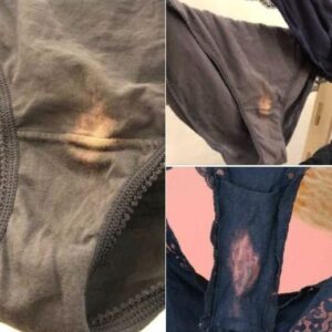 This is what it means if you find a “bleach” spot on your.. This is what it means if you find a “bleach” spot on your..