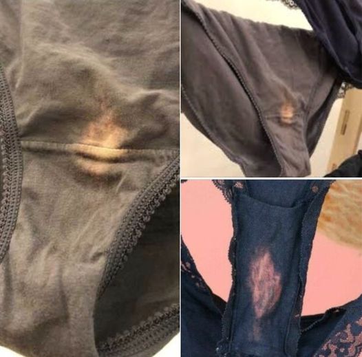 This is what it means if you find a “bleach” spot on your.. This is what it means if you find a “bleach” spot on your..
