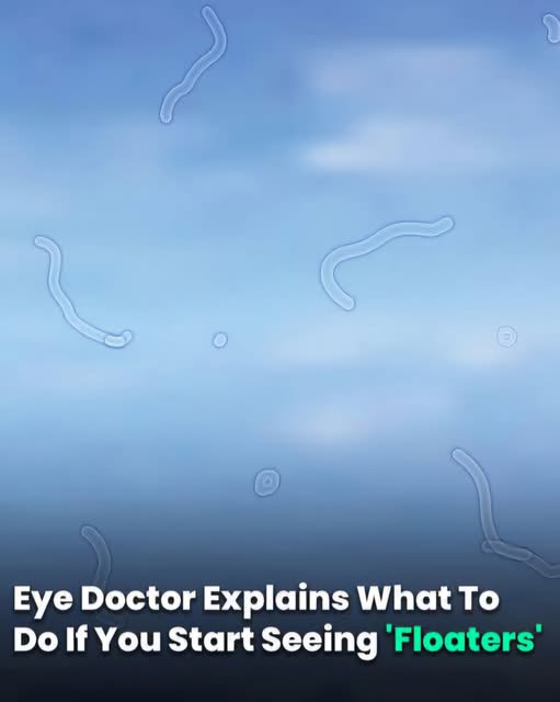 What Are Eye Floaters? Here What To Do If you Start Seeing Them, According to an Eye Doctor