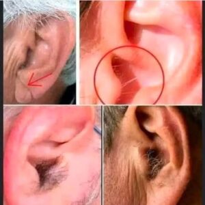 Did you know that if your ear hairs grow, it is because your body is Did you know that if your ear hairs grow, it is because your body is