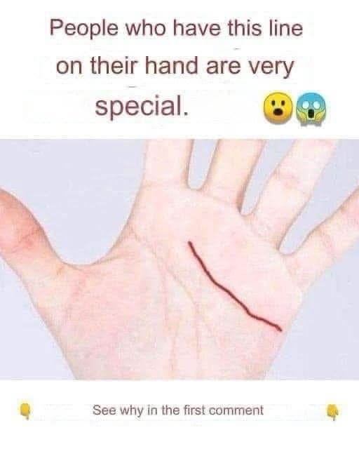 People who have this line on their People who have this line on their