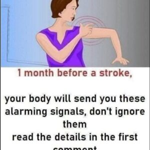 Stroke: These indicators that manifest one month prior to.. Stroke: These indicators that manifest one month prior to..