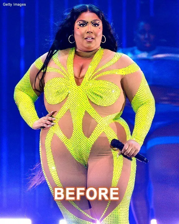 “Singer Lizzo, 36, Shows Off Slimmer Figure in Off-Shoulder Dress Following Significant Weight Loss: ‘I’m Loving This New Look’” “Singer Lizzo, 36, Shows Off Slimmer Figure in Off-Shoulder Dress Following Significant Weight Loss: ‘I’m Loving This New Look’”
