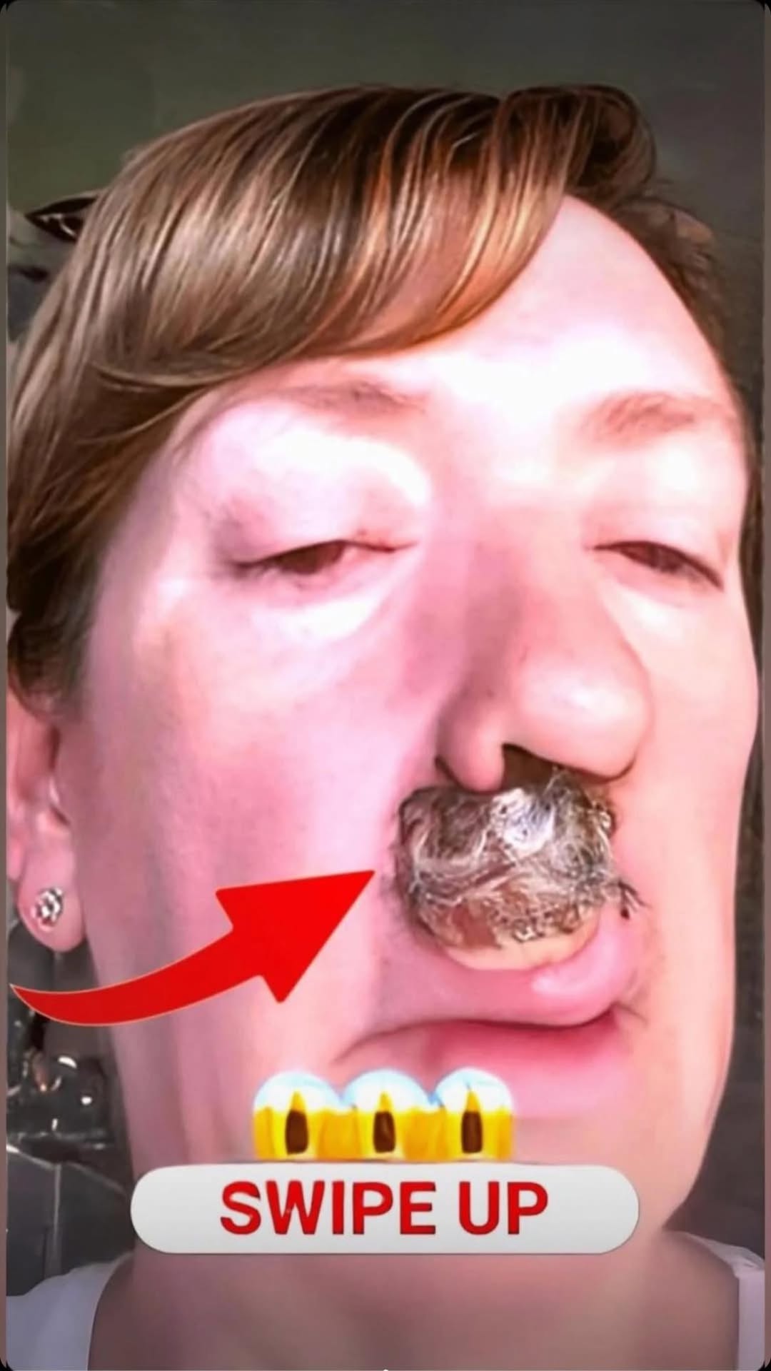 What Causes this!