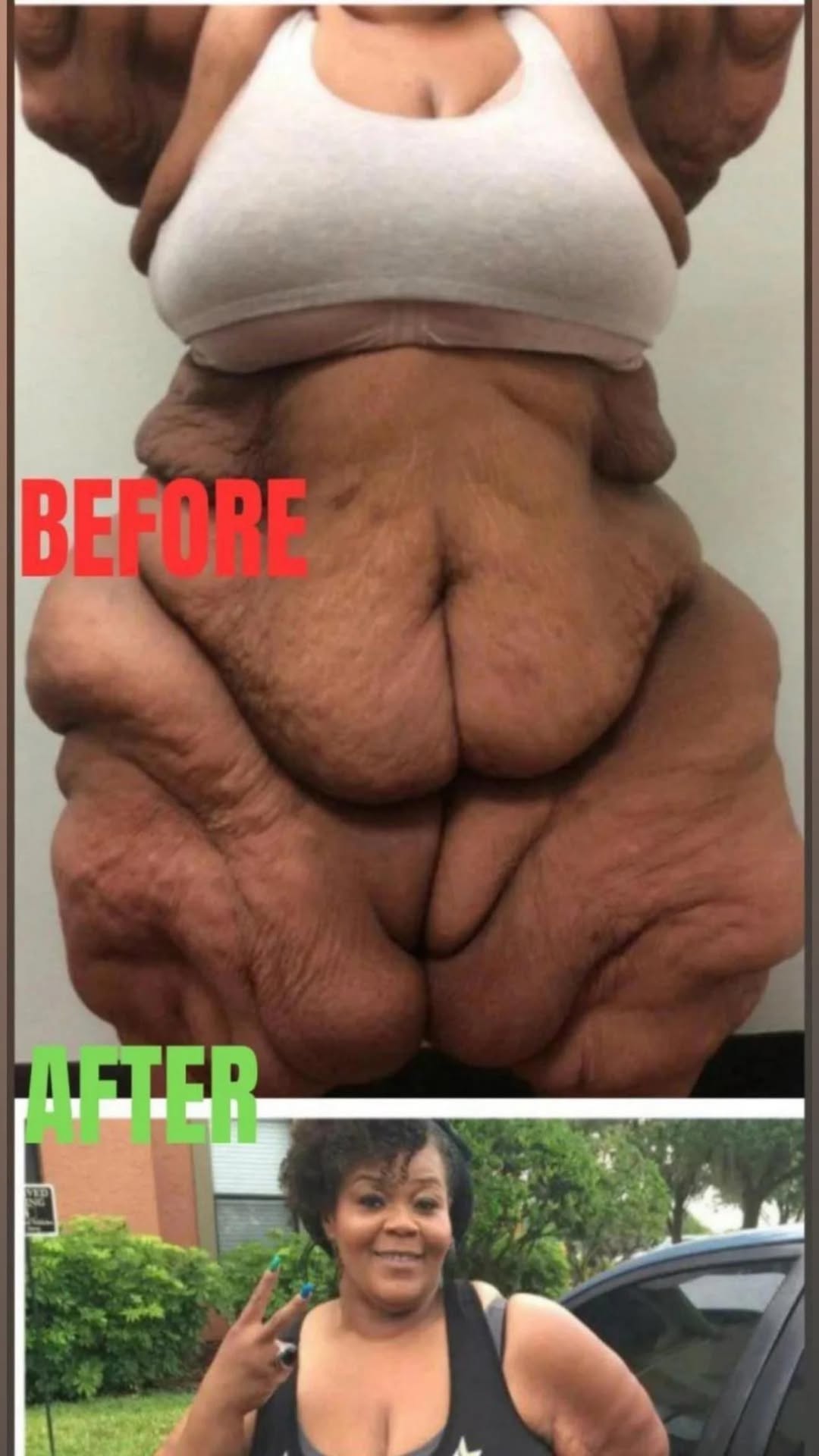 The world’s heaviest woman! The world’s heaviest woman!