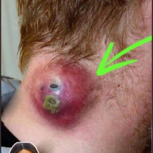Unbelievable – What Causes this! Unbelievable – What Causes this!