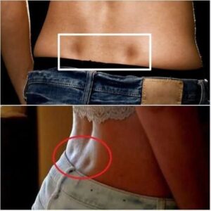 If you have these two holes in your back, it means you don’t If you have these two holes in your back, it means you don’t