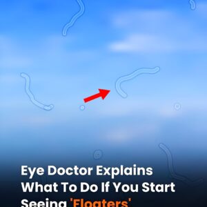 What Are Eye Floaters? Here What To Do If you Start Seeing Them What Are Eye Floaters? Here What To Do If you Start Seeing Them