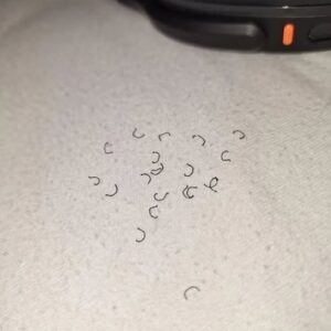 Woke Up To This On Your Bed? The Truth Will Shock You!