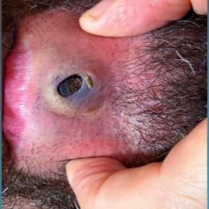 10 Bug Bites Anyone Should Be Able to Identify 10 Bug Bites Anyone Should Be Able to Identify