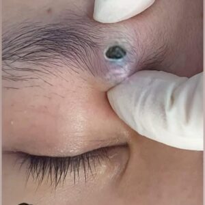 10 Early Signs of Health Problems You Shouldn’t Ignore