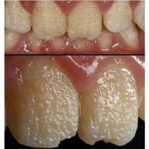 his is what your teeth will become when you eat… his is what your teeth will become when you eat…