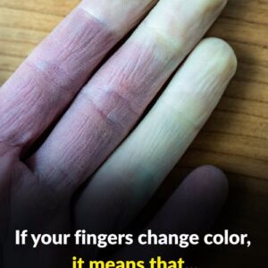 Why do fingers change color? Why do fingers change color?