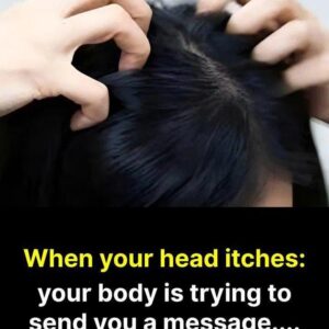 Itchy Scalp? Here Are the Most…