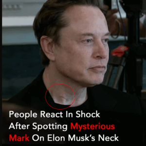 Elon Musk’s mysterious neck mark sparks reactions online