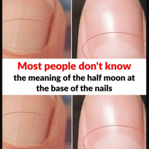 What does the half moon at the base of the nails mean? What does the half moon at the base of the nails mean?