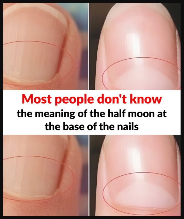 What does the half moon at the base of the nails mean?