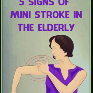 Mini Str0ke in the Elderly: Common and Unusual Symptoms