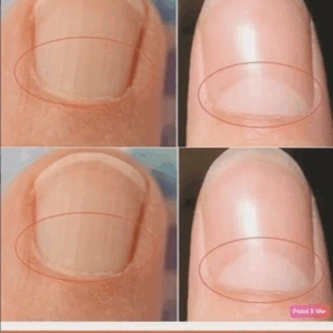 If you don’t have a crescent moon shape on your nails