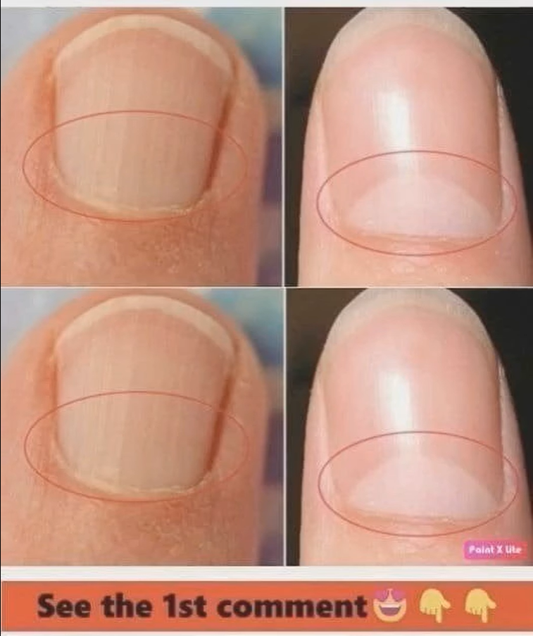 If you don’t have a crescent moon shape on your nails