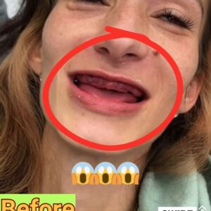 Former drug addict transformed with drastic K smile makeover Former drug addict transformed with drastic K smile makeover