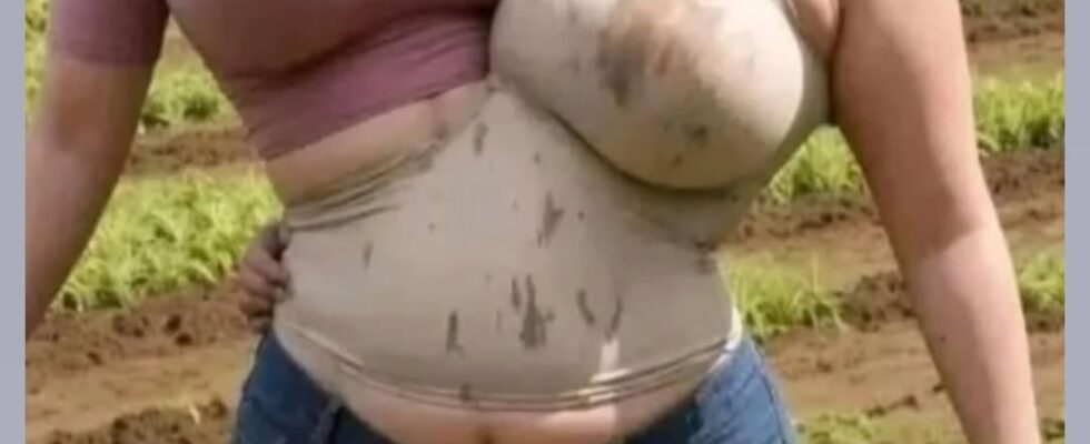Wow – Conjoined Twins!