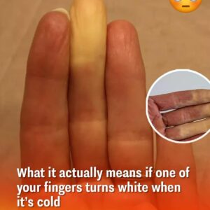 You may have spotted this on someone you know