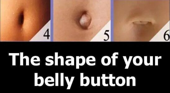 See The shape of your belly button reveals your personality