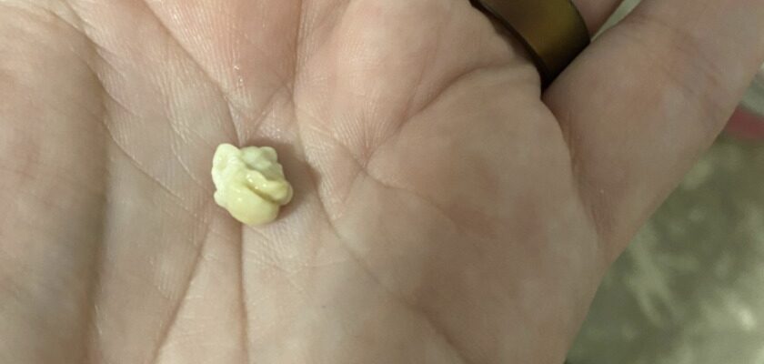 Person Stunned After Waking Up With This Rolling Around In Their Mouth
