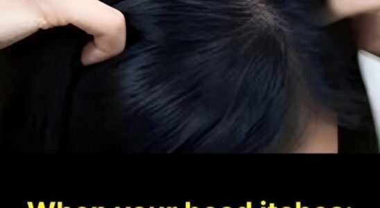 Itchy Scalp? Here Are the Most Common Causes