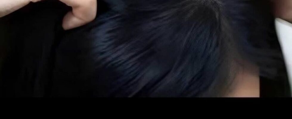 Itchy Scalp? Here Are the Most Common Causes