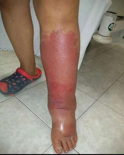 This Signs on your FEET