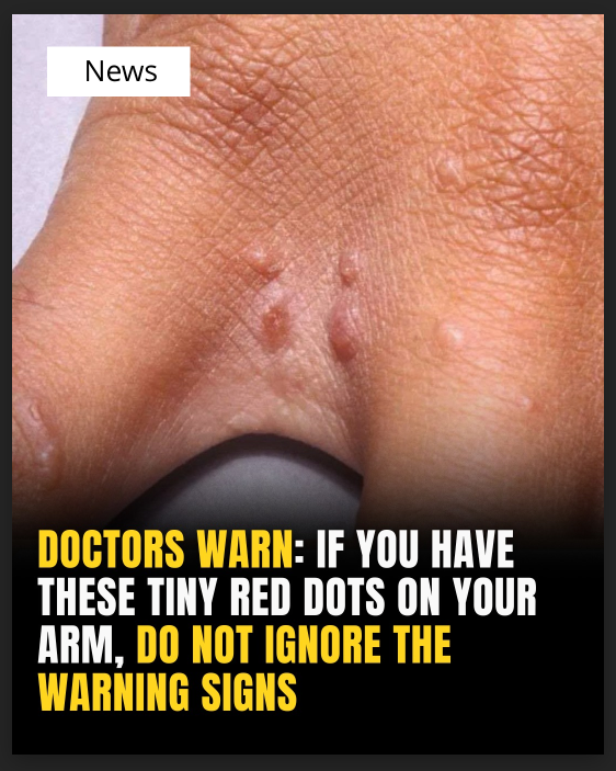 Off The RecordIf You Have These Tiny Red Dots On Your Arm, Do Not Ignore!