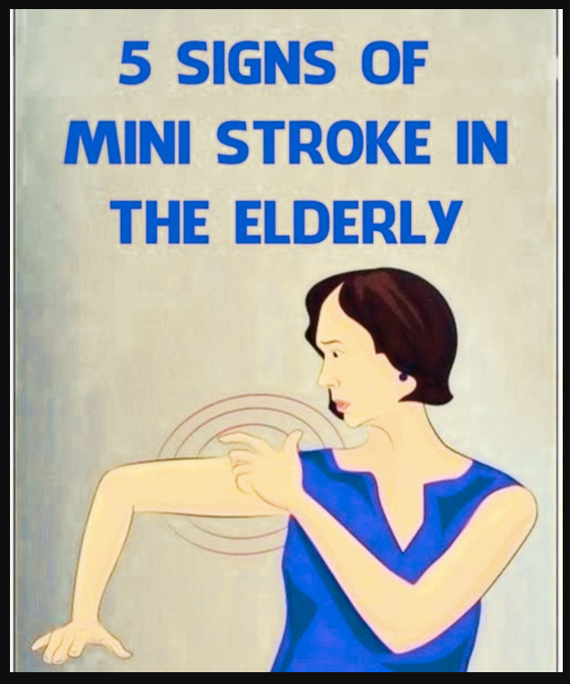 Mini Str0ke in the Elderly!