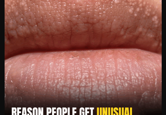 What Are Those White Bumps That Can Appear?