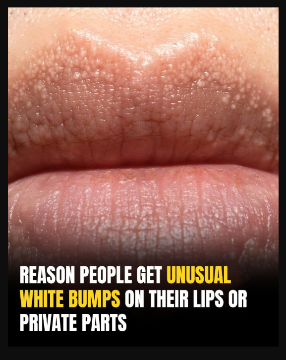 What Are Those White Bumps That Can Appear?