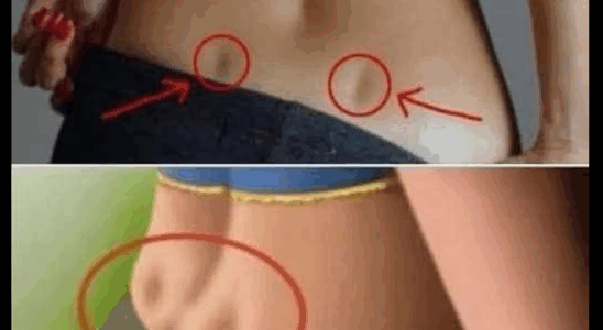 See If you have these two holes in your back, it means you dont