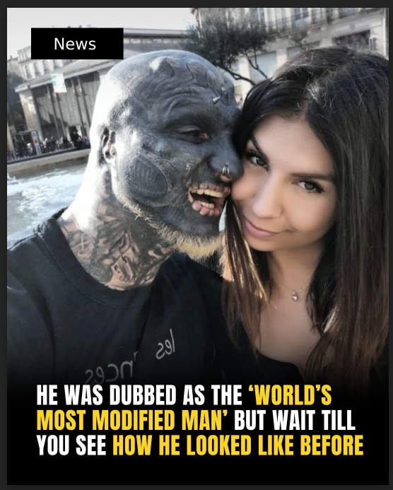 He Was Dubbed As The ‘World’s Most Modified Man’ But Wait Till You See How He Looked Like Before