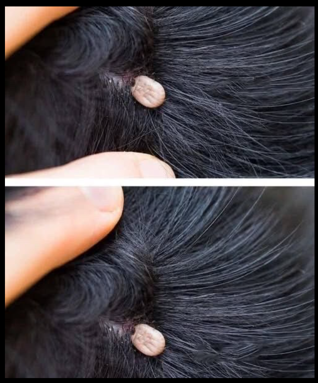 What You Should Do If You Discover Something Strange in Your Child’s Hair