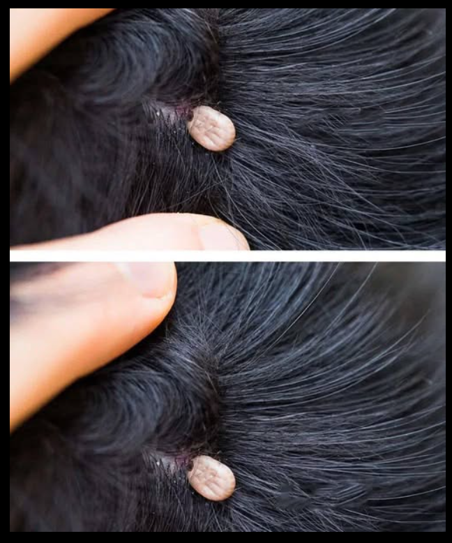 Just Discovered This In My Son’s Hair