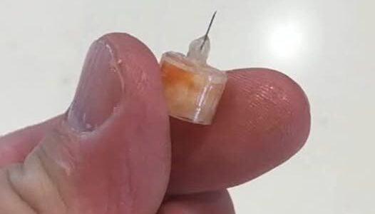 57 times people had no idea
