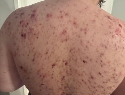 These are the consequences…