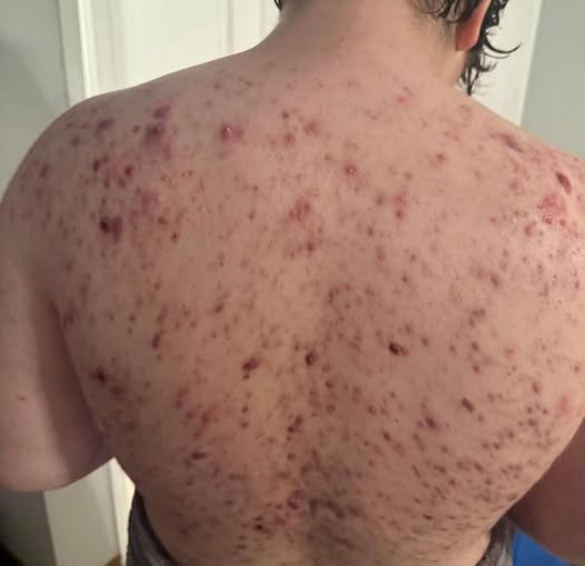 These are the consequences…